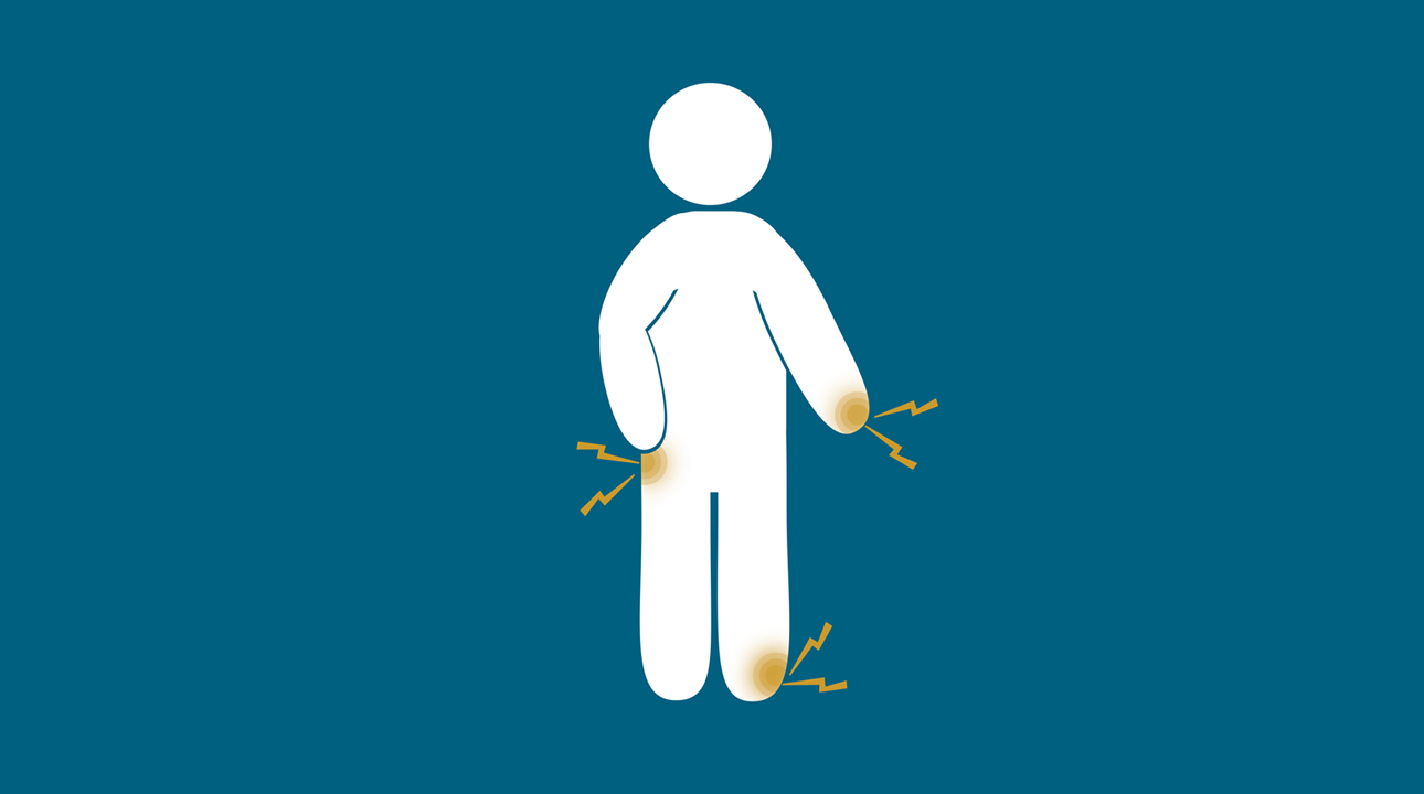 FAQs About Fibromyalgia